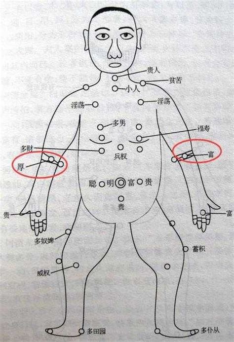 左手臂 痣